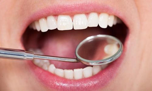 a closeup of a smile during a dental checkup