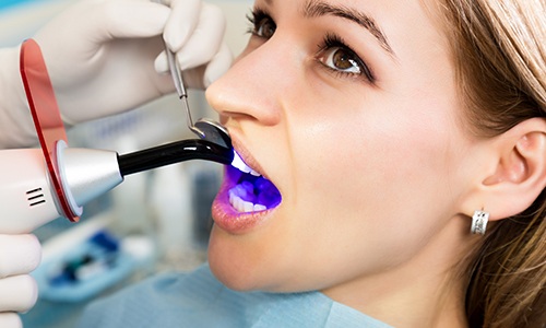 Patient receiving cosmetic dental bonding treatment