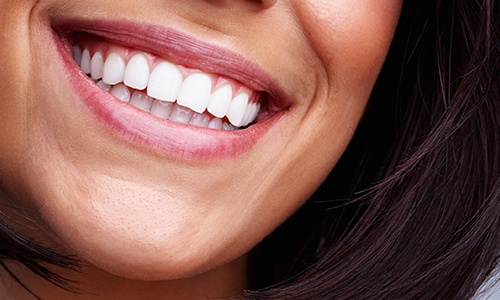 Closeup of bright smile after teeth whitening