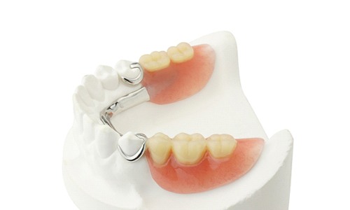 Model partial dentures in Webster on model jaw