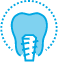 Animated dental implant supported replacement tooth symbolizing replacing missing teeth