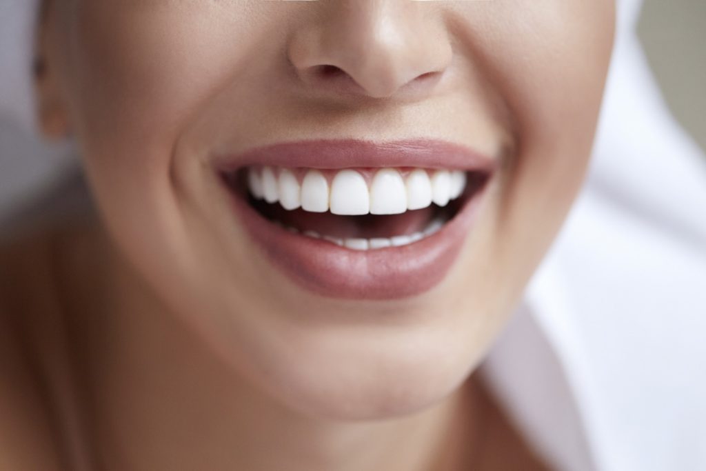 Closeup of woman with veneers smiling