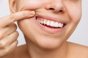 a closeup of a patient showing off their teeth